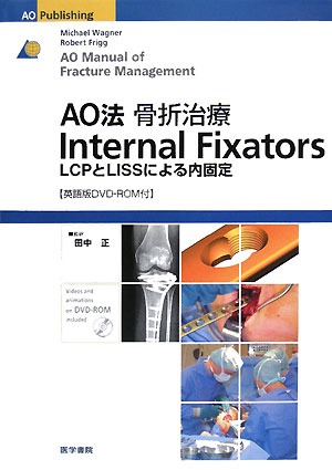 AO法骨折治療internal　fixators