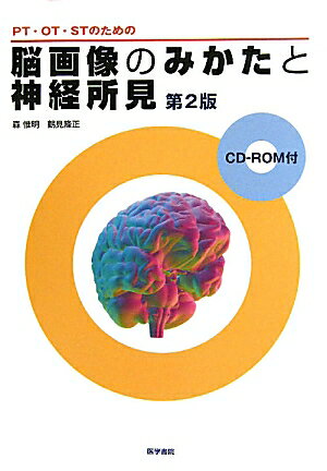 PT・OT・STのための脳画像のみかたと神経所見