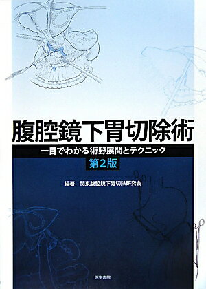 腹腔鏡下胃切除術第2版