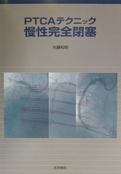 PTCAテクニック慢性完全閉塞