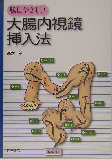 腸にやさしい大腸内視鏡挿入法