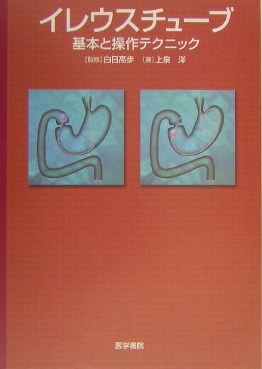 イレウスチュ-ブ