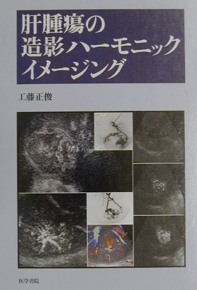 肝腫瘍の造影ハ-モニックイメ-ジング