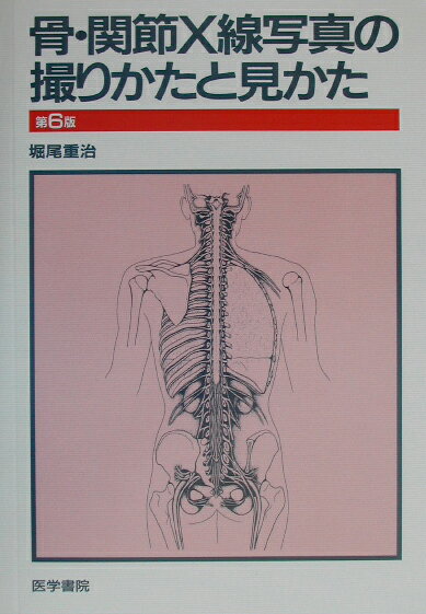 骨・関節X線写真の撮りかたと見かた第6版