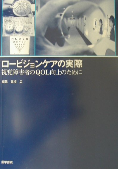 ロービジョンケアの実際