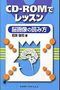 CD-ROMでレッスン脳画像の読み方