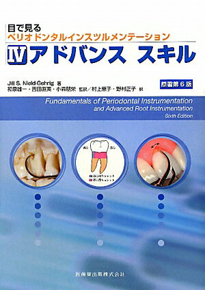 目で見るペリオドンタルインスツルメンテーション（4）