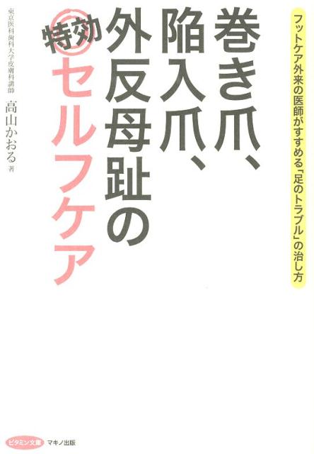 巻き爪、陥入爪、外反母趾の特効セルフケア