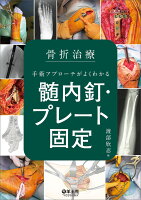 骨折治療 手術アプローチがよくわかる髄内釘・プレート固定