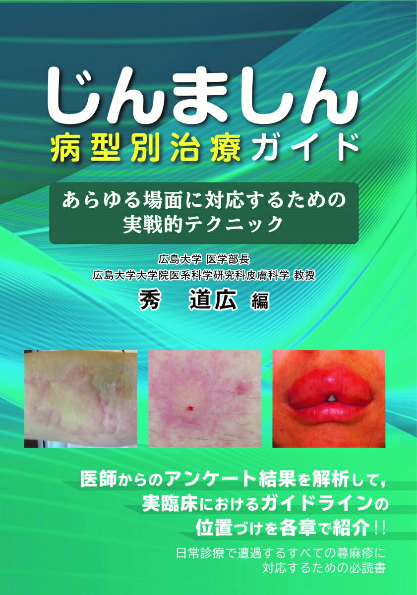 じんましん病型別治療ガイド
