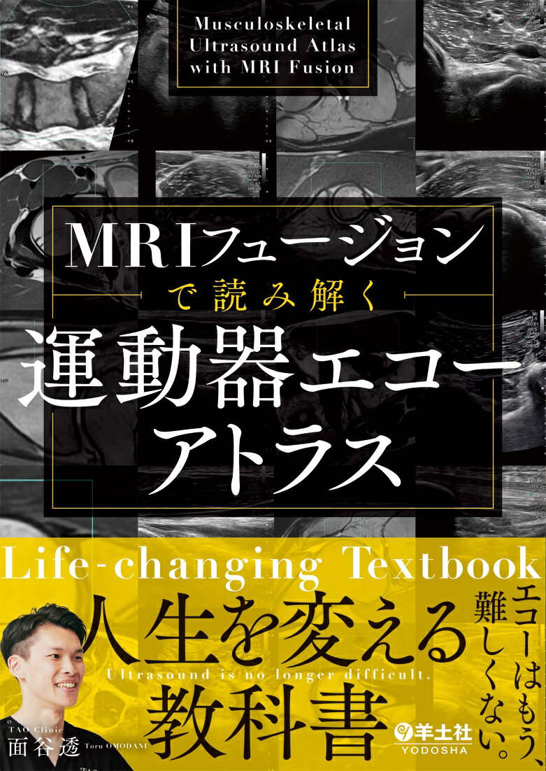 MRIフュージョンで読み解く　運動器エコーアトラス [ 面谷　透 ] 2
