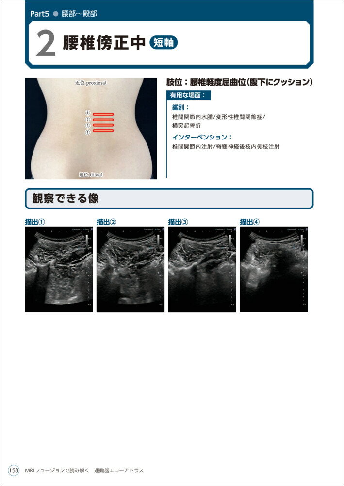 MRIフュージョンで読み解く　運動器エコーアトラス [ 面谷　透 ] 3
