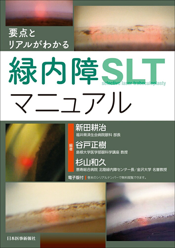 要点とリアルがわかる　緑内障SLTマニュアル