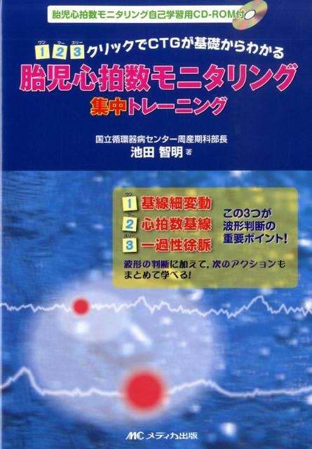 胎児心拍数モニタリング集中トレーニング