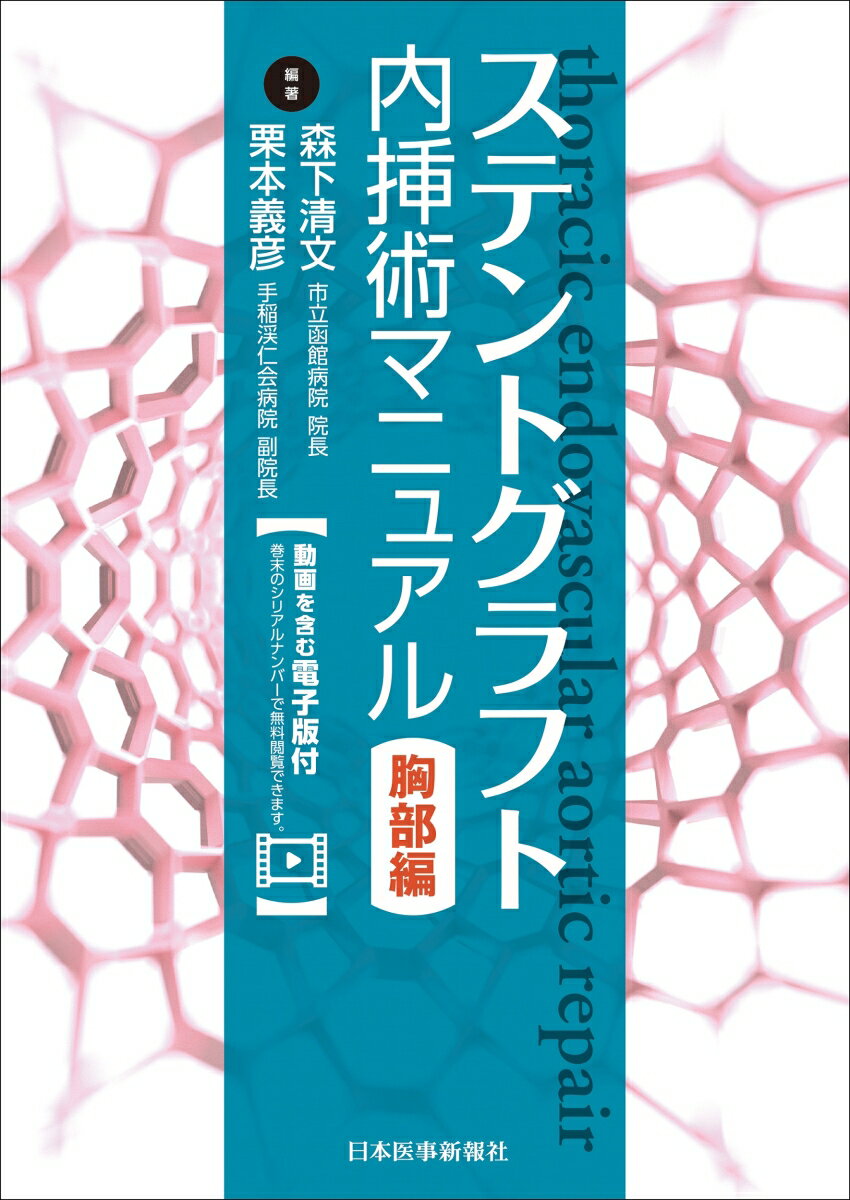 ステントグラフト内挿術マニュアル 胸部編 [ 森下清文 ]