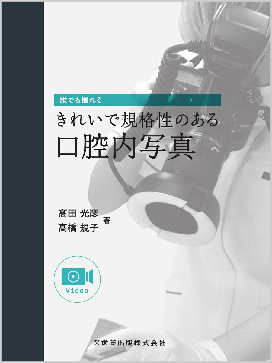 誰でも撮れるきれいで規格性のある口腔内写真