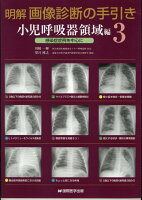 明解画像診断の手引き小児呼吸器領域編（3）