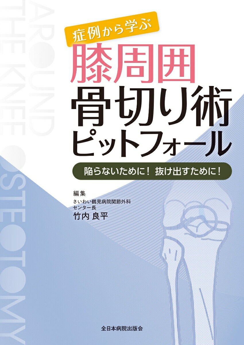 症例から学ぶ 膝周囲骨切り術ピットフォール