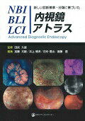 新しい診断基準・分類に基づいたNBI　BLI　LCI内視鏡アトラス