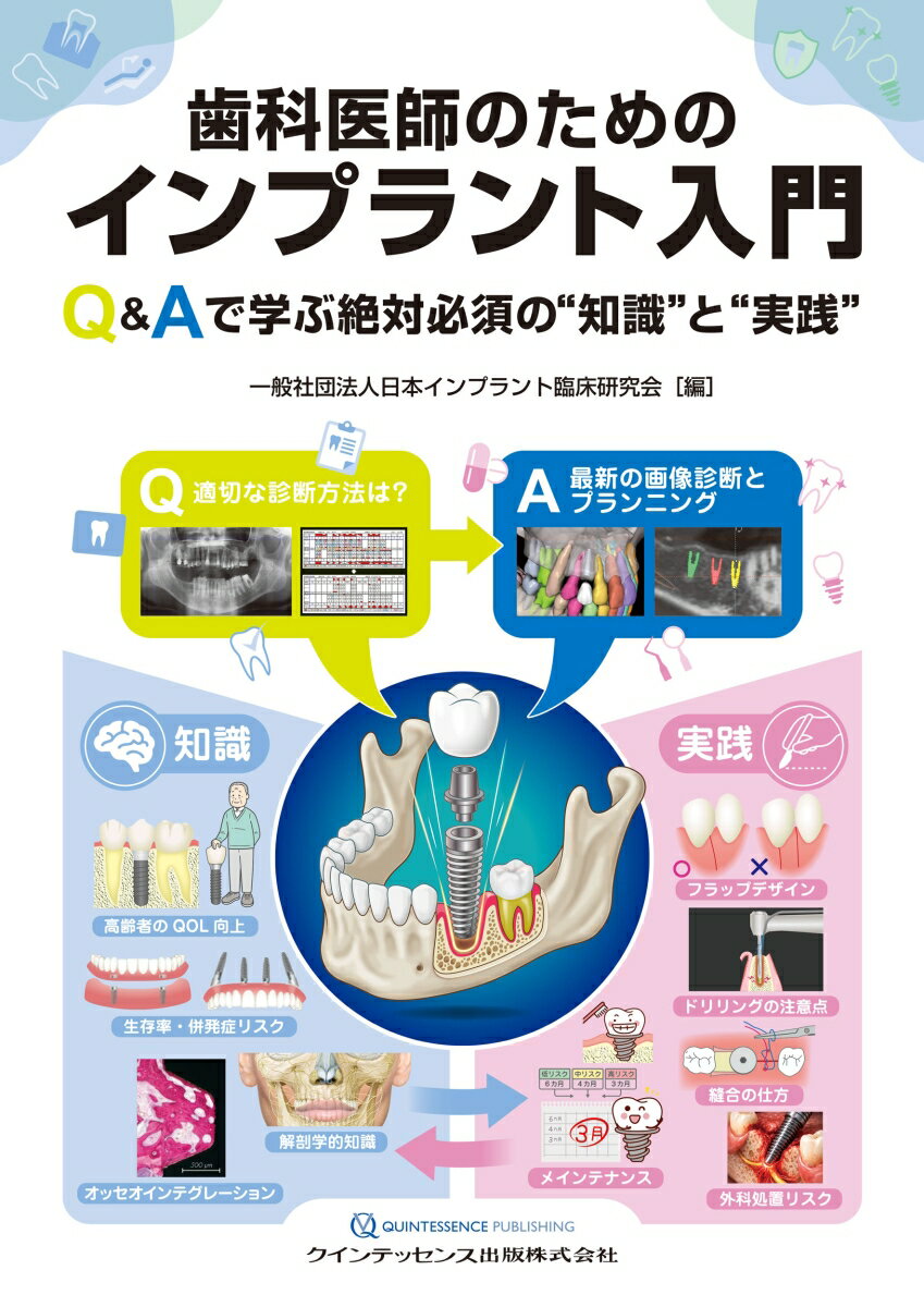 歯科医師のためのインプラント入門