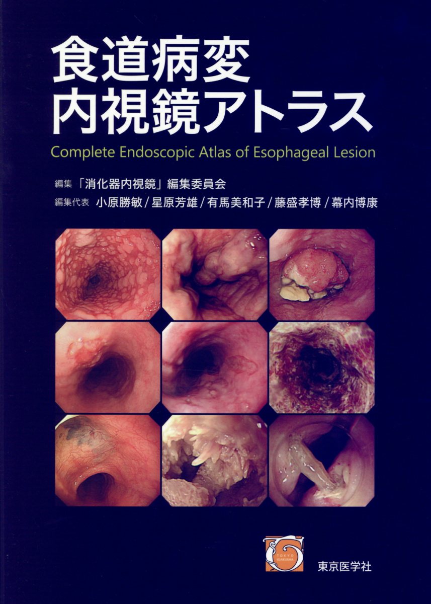 食道病変内視鏡アトラス