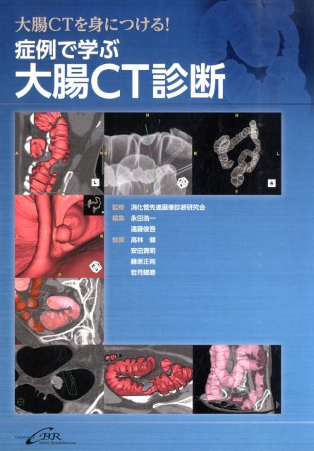 症例で学ぶ大腸CT診断