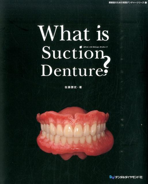 What　is　Suction　Denture？