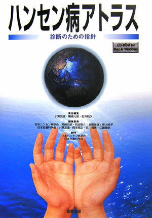 ハンセン病アトラス