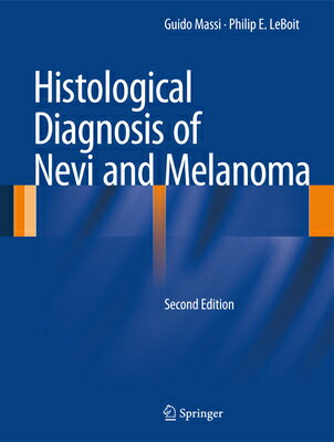 Histological Diagnosis of Nevi and Melanoma HISTOLOGICAL DIAGNOSIS OF NEVI 