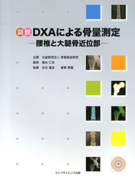 図説DXAによる骨量測定 腰椎と大腿骨近位部 友光達志