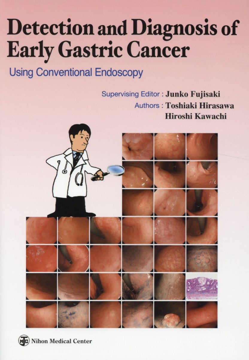 Detection and Diagnosis of Early Gastric