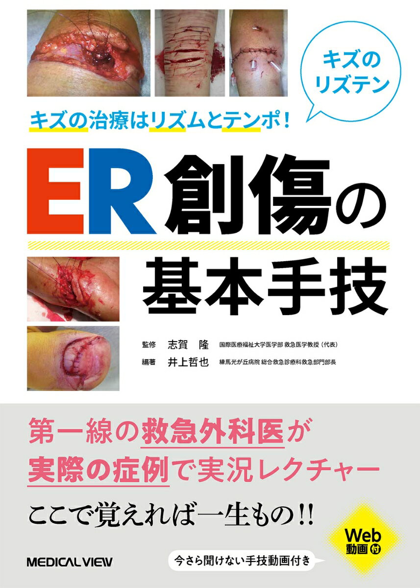 キズの評価、洗浄、麻酔。器具の使い方、縫合・結紮の手技。各部位のキズ（頭皮、額、眼、耳、鼻、唇、舌、手、爪）。複雑なキズ、デブリードマン、ドレナージ。動物咬傷、軽症熱傷、湿潤療法…。この１冊でまるわかり！第一線の救急外科医が実際の症例で実況レクチャー。ここで覚えれば一生もの！！