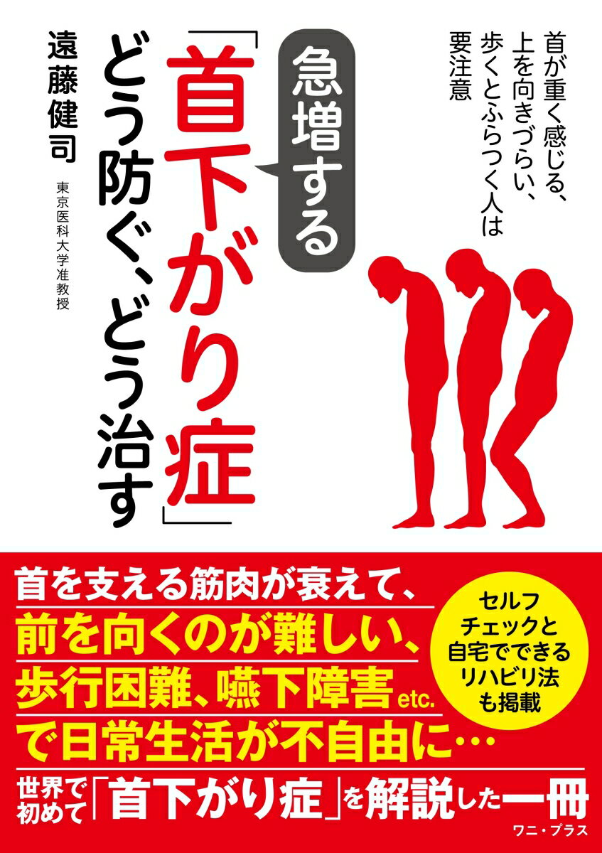 急増する「首下がり症」どう防ぐ、どう治す - 首が重く感じる、上を向きづらい、歩くとふらつく人は要注意 - [ 遠藤 健司 ]