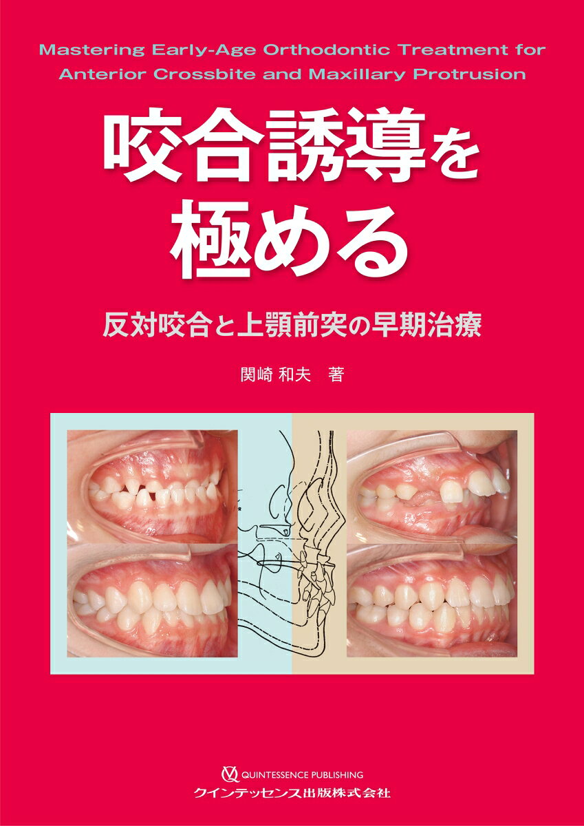 ザ・クインテッセンスで好評を博した特集連載に2章分の書き下ろしを加えて書籍化。ロングセラー『GPのための咬合誘導』の著者が、成長発育の診断から、小児期の反対咬合と上顎前突の検査、予防と治療の実際について、多くの文献、規格化された膨大な資料、多数の経過症例とともに解説。ファミリーデンティスト（GP）だからできる、成長発育を考慮した適切な時期の早期治療のノウハウが満載であり、全歯科医師必読の書といえる。