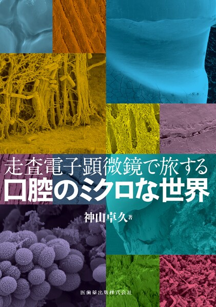 走査電子顕微鏡で旅する口腔のミクロな世界