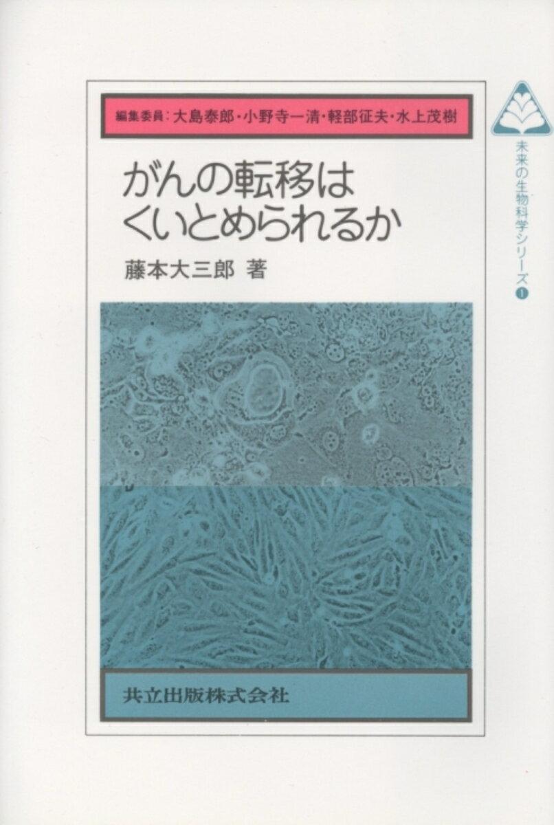 がんの転移はくいとめられるか