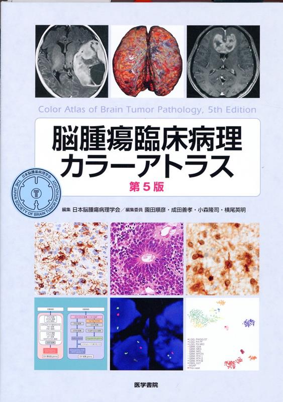 脳腫瘍臨床病理カラーアトラス 第5版