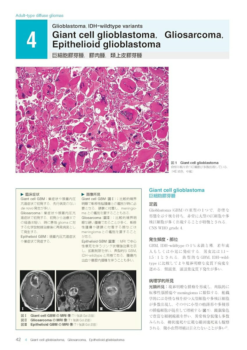 脳腫瘍臨床病理カラーアトラス 第5版 [ 日本脳腫瘍病理学会 ] 2