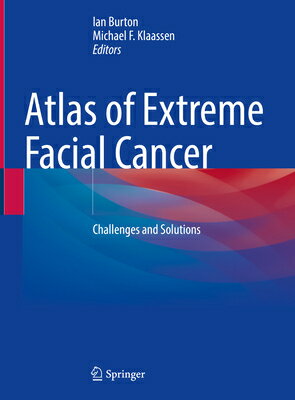 Atlas of Extreme Facial Cancer: Challenges and Solutions ATLAS OF EXTREME FACIAL CANCER [ Ian Burton ]