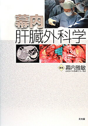 幕内肝臓外科学