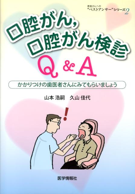 口腔がん，口腔がん検診Q＆A