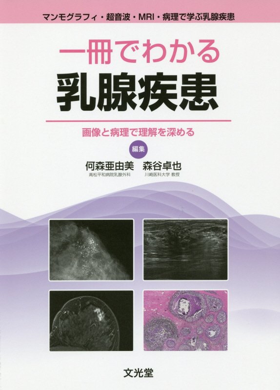 マンモグラフィ・超音波・ＭＲＩ・病理で学ぶ乳腺疾患。