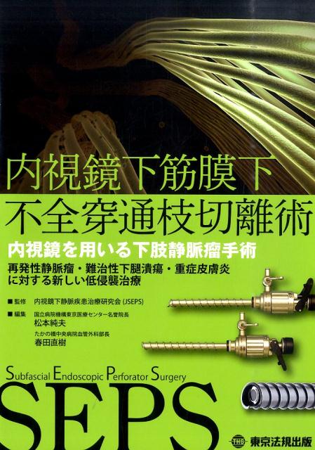 内視鏡下筋膜下不全穿通枝切離術