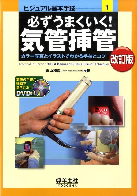 必ずうまくいく！気管挿管改訂版