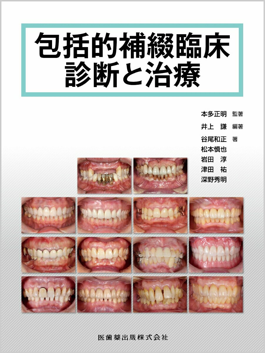 包括的補綴臨床診断と治療