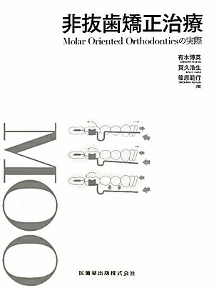 非抜歯矯正治療