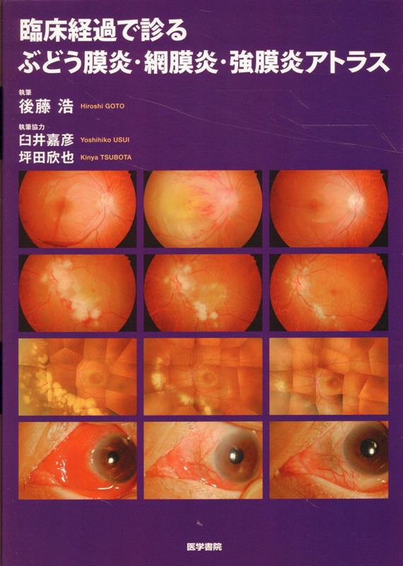 臨床経過で診る ぶどう膜炎・網膜炎・強膜炎アトラス