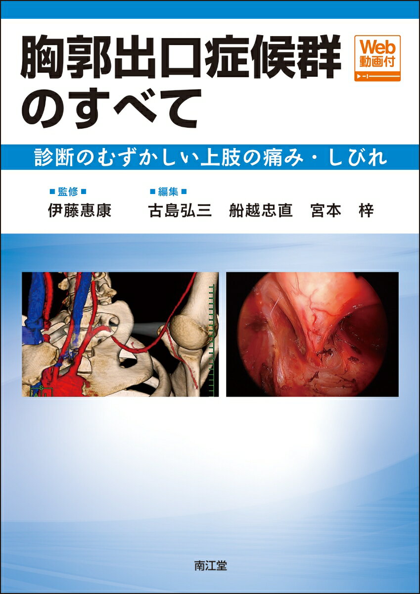 胸郭出口症候群のすべて［Web動画付］ 診断のむずかしい上肢の痛み・しびれ [ 伊藤惠康 ]