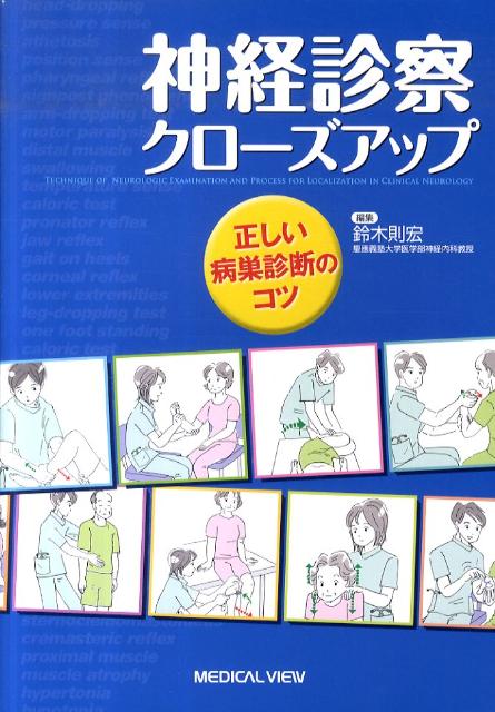 神経診察クローズアップ
