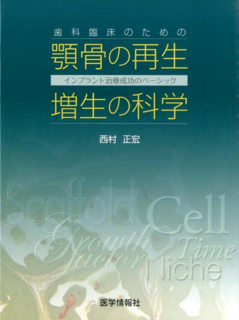 歯科臨床のための顎骨の再生・増生の科学